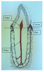 Divisões coroa e raiz e localização da polpa coronária e radicular.